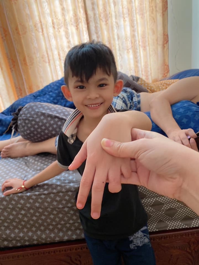 រូបភាព ដែលបង្ហាញថា ក្មេងប្រុសរូបនេះ ត្រូវកាត់ពីរម្រាមដៃ